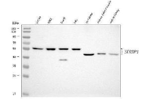 Western blot analysis of SERBP1 using anti-SERBP1 antibody (ABIN7602927).