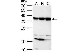 WB Image C11orf54 antibody detects C11orf54 protein by Western blot analysis. (C11orf54 Antikörper)