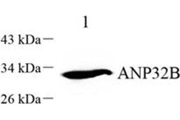 ANP32B Antikörper