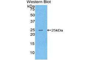 Western Blotting (WB) image for anti-Filaggrin (FLG) (AA 3905-4031) antibody (ABIN1078038) (Filaggrin Antikörper  (AA 3905-4031))