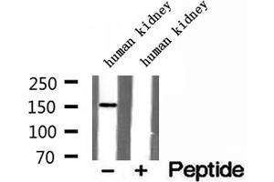Western blot analysis of extracts of human kidney tissue, using RPGRIP1L antibody.