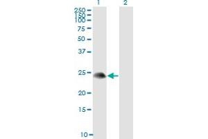 Western Blot analysis of TSC22D3 expression in transfected 293T cell line by TSC22D3 monoclonal antibody (M01), clone 3A5. (TSC22D3 Antikörper  (AA 1-97))