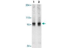 Western blot analysis of NARP2 in PC-3 cell lysate with NLRP2 polyclonal antibody  at 1 and 2 ug/mL .