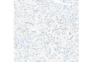 Immunohistochemistry (IHC) image for anti-Jun Dimerization Protein 2 (JDP2) (AA 50-100) antibody (ABIN7795636) (Rekombinanter JDP2 Antikörper  (AA 50-100))