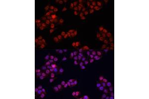Immunofluorescence analysis of HeLa cells using Y antibody (ABIN6132789, ABIN6150317, ABIN6150322 and ABIN6215136) at dilution of 1:100. (YAP1 Antikörper  (AA 155-504))