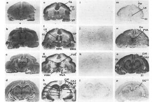 Distribution of 5-ht7 receptor binding and mRNA in guinea-pig coronal forebrain sections dissected form guinea pig brains (p/n GP-T040).