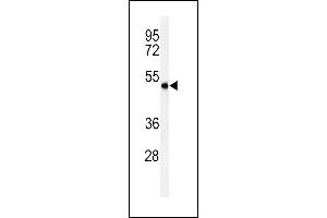 SMPDL3A Antikörper  (C-Term)