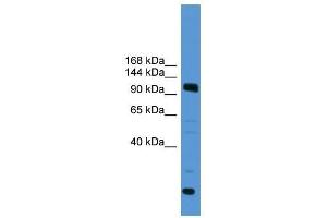 Western Blot showing USP15 antibody used at a concentration of 1-2 ug/ml to detect its target protein. (USP15 Antikörper  (C-Term))