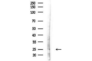 Western blot analysis of lysates from LoVo cells(heat-shock,45 min treatment), using FGF2 Antibody at 1/1000 dilution.