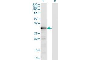 Western Blot analysis of TYMS expression in transfected 293T cell line by TYMS monoclonal antibody (M02), clone 2B2.
