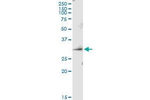 Immunoprecipitation of PRSS1 transfected lysate using anti-PRSS1 MaxPab rabbit polyclonal antibody and Protein A Magnetic Bead , and immunoblotted with PRSS1 purified MaxPab mouse polyclonal antibody (B01P) . (PRSS1 Antikörper  (AA 1-247))