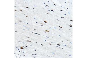 Immunohistochemistry (IHC) image for anti-TEA Domain Family Member 1 (SV40 Transcriptional Enhancer Factor) (TEAD1) (AA 135-215) antibody (ABIN6148982)