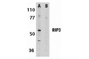 Western Blotting (WB) image for anti-Myosin Phosphatase rho Interacting Protein (MPRIP) antibody (ABIN1031778)