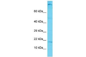 Host: Rabbit Target Name: C12orf74 Sample Type: Hela Whole cell lysates Antibody Dilution: 1. (C12ORF74 Antikörper  (N-Term))