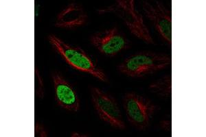 Immunofluorescent staining of HeLa cells with ANLN monoclonal antibody, clone CL0303  (Green) shows cell cycle dependent nuclear (without nucleoli) staining.