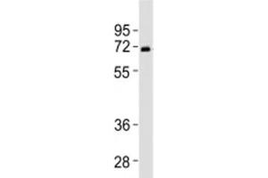 Western blot testing of SPHK2 antibody at 1:2000 dilution + human liver lysate (SPHK2 Antikörper  (N-Term))