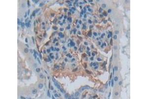 Immunohistochemistry (IHC) image for anti-Aurora Kinase C (AURKC) (AA 92-339) antibody (ABIN5013211)