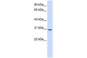 RBM7 antibody used at 1 ug/ml to detect target protein. (RBM7 Antikörper  (Middle Region))