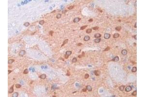 Detection of HGF in Rat Cerebrum Tissue using Polyclonal Antibody to Hepatocyte Growth Factor (HGF) (HGF Antikörper  (AA 306-471))