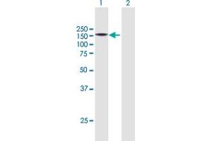 Western Blot analysis of KIAA0319L expression in transfected 293T cell line by KIAA0319L MaxPab polyclonal antibody. (KIAA0319L Antikörper  (AA 1-1049))