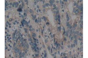 Immunohistochemistry (IHC) image for anti-Bcl2 Modifying Factor (BMF) (AA 1-181) antibody (ABIN7442702)