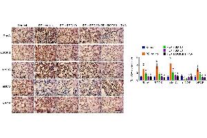 IHC analyzes the expression of RhoA, ROCK, p-MLC, eNOS and VEGF in placenta from PE miceRepresentative images of IHC staining for RhoA, ROCK, p-MLC, eNOS and VEGF (left), and quantification (right). (VEGFA Antikörper  (AA 81-132))