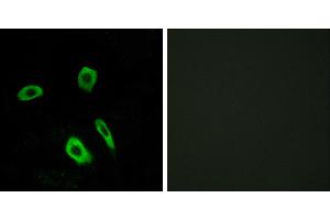 Peptide - +Western blot analysis of extracts from Jurkat cells, using EDG7 antibody. (LPAR3 Antikörper  (Internal Region))