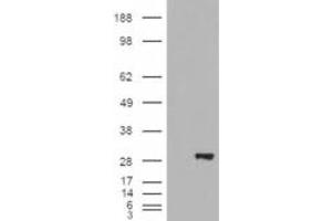 HEK293 overexpressing BDH2 (RC210586) and probed with ABIN238652 (mock transfection in first lane), tested by Origene.
