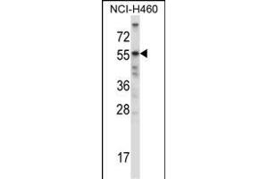 Western Blotting (WB) image for anti-Activin A Receptor, Type IIB (ACVR2B) (AA 148-176) antibody (ABIN657829)