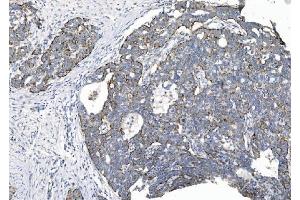 IHC analysis of CHCHD10 using anti-CHCHD10 antibody (ABIN7602507). (CHCHD10 Antikörper  (AA 80-142))