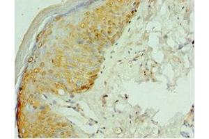 Immunohistochemistry (IHC) image for anti-Radical S-Adenosyl Methionine Domain Containing 2 (RSAD2) (AA 42-361) antibody (ABIN7167058)