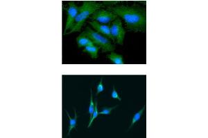 ICC/IF analysis of GAS7 in HeLa cells line, stained with DAPI (Blue) for nucleus staining and monoclonal anti-human GAS7 antibody (1:100) with goat anti-mouse IgG-Alexa fluor 488 conjugate (Green). (GAS7 Antikörper)