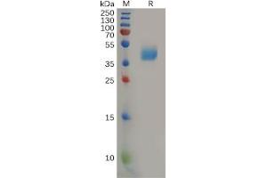 Human CCR2 Protein, hFc Tag on SDS-PAGE under reducing condition.