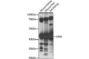 Western blot analysis of extracts of various cell lines, using UPB1 antibody. (UPB1 Antikörper)