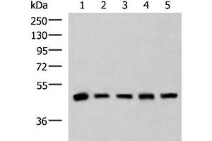 Western blot analysis of Human fetal liver tissue HepG2 A172 Hela and Jurkat cell lysates using PCYT2 Polyclonal Antibody at dilution of 1:800 (PCYT2 Antikörper)