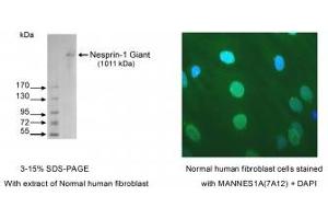Image no. 1 for anti-Spectrin Repeat Containing, Nuclear Envelope 1 (SYNE1) antibody (ABIN1042627) (SYNE1 Antikörper)