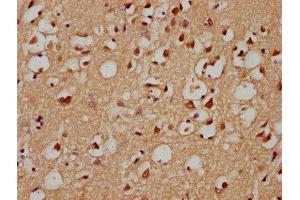 IHC image of ABIN7154372 diluted at 1:300 and staining in paraffin-embedded human brain tissue performed on a Leica BondTM system. (GRHL1 Antikörper  (AA 1-95))