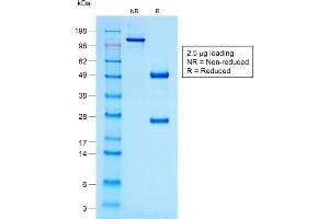 SDS-PAGE Analysis Purified ACTH Mouse Recombinant Monoclonal Antibody (r57). (Rekombinanter POMC Antikörper  (N-Term))
