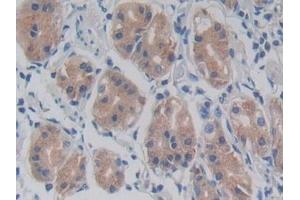 Detection of TLR5 in Human Stomach Tissue using Monoclonal Antibody to Toll Like Receptor 5 (TLR5) (TLR5 Antikörper  (AA 693-858))