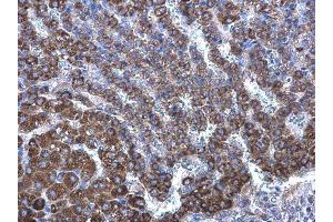 Immunohistochemistry (IHC) image for anti-24-Dehydrocholesterol Reductase (DHCR24) antibody (ABIN2855685)