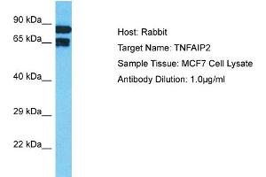 Host: Rabbit Target Name: TNFAIP2 Sample Tissue: Human MCF7 Whole Cell Antibody Dilution: 1ug/ml (TNFAIP2 Antikörper  (N-Term))