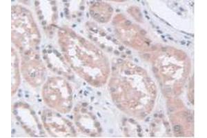 IHC-P analysis of Human Kidney Tissue, with DAB staining. (STIP1 Antikörper  (AA 1-169))