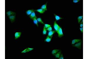 Immunofluorescence staining of Hela cells with ABIN7143957 at 1:133, counter-stained with DAPI. (ALMS1 Antikörper  (AA 889-1057))