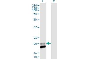 Western Blot analysis of IFNA13 expression in transfected 293T cell line by IFNA13 MaxPab polyclonal antibody. (IFNA13 Antikörper  (AA 1-189))