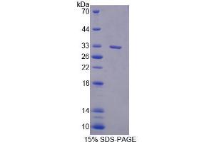 SDS-PAGE analysis of Human PLCd1 Protein. (PLCD1 Protein)