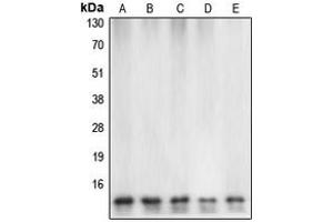 Western blot analysis of Caspase 7 expression in HeLa (A), mouse heart (B), rat heart (C), Jurkat etoposid-treated (D), HEK293T (E) whole cell lysates. (Caspase 7 Antikörper  (Center))