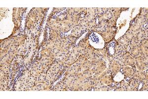 Detection of PIIINP in Human Kidney Tissue using Monoclonal Antibody to Procollagen III N-Terminal Propeptide (PIIINP) (PIIINP Antikörper)