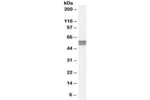 Western blot testing of human bone marrow lysate with CACNB4 antibody at 0. (CACNB4 Antikörper)