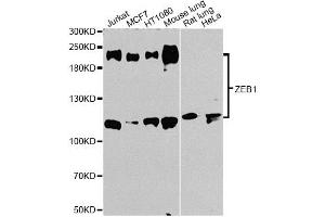 Western blot analysis of extracts of various cell lines, using ZEB1 antibody (ABIN1875385) at 1:1000 dilution. (ZEB1 Antikörper)