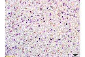 Formalin-fixed and paraffin embedded rat brain labeled with Anti-CHMP4B/CHMP4C Polyclonal Antibody, Unconjugated (ABIN872575) at 1:200 followed by conjugation to the secondary antibody and DAB staining.